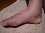 0608kossetu3.jpg
