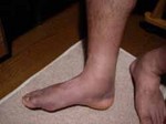 0608kossetu4.jpg